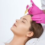 hair loss treatment